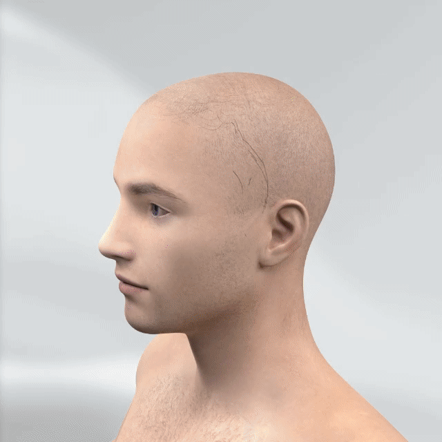 NESLEMY™ Hair Regrowth System