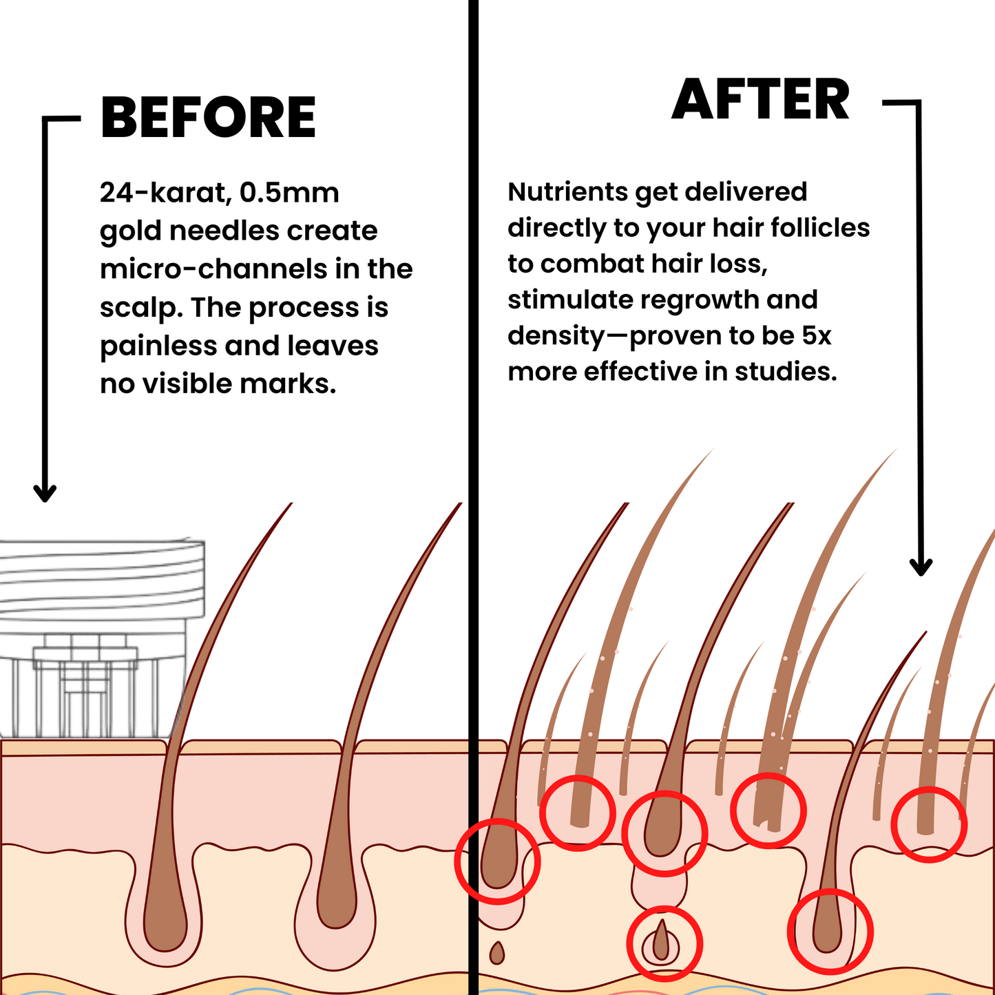 NESLEMY™ Hair Regrowth System